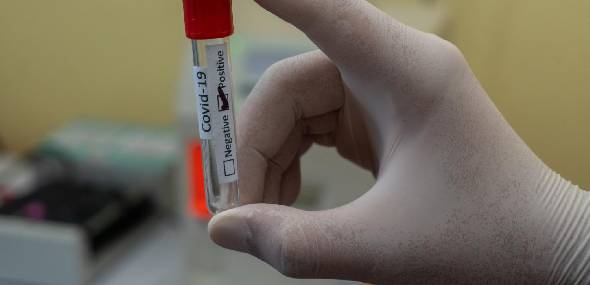 Coronavírus: sequelas pulmonares pós-covid