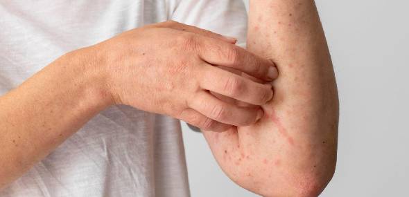 Doenças alérgicas: saiba o que são e entenda como diagnosticá-las e tratá-las
