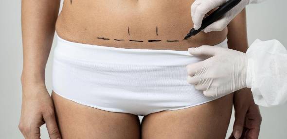 Lipoaspiração, minilipo, hidrolipo e lipo HD: entenda esses procedimentos