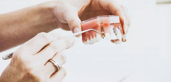 Novas tecnologias em implantes dentários