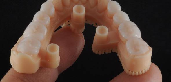 Precision Laboratório Explica: A Conexão Entre Odontologia, Próteses Dentárias, Tecnologia e Arte